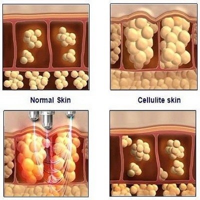 در واقع پوست ها به دلایل گوناگونی صدمه می بینند مثلاً:
